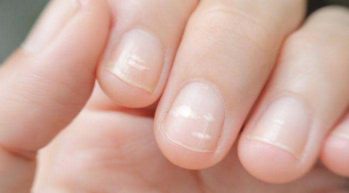 Cum previi si/sau tratezi alergia la produsele de manichiura